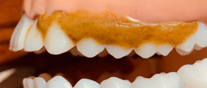 Pearly teeth wax holistic tooth application - Apply step